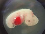 Have You Heard About The Human–Pig Hybrid?