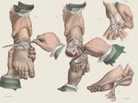 This Is How Surgeries Were Done In The Victorian Era