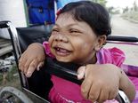 The Mysterious Case Of A Woman Who Is 24 Years Old & Looks Like A Toddler!
