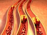 Things Dietitians Wish You Knew About High Cholesterol