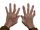  The Ultimate Ancient Remedy To Treat Arthritis And Lower Cholesterol