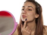 How To Actually Get Rid Of Pimples