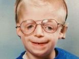 He Had A Genetic Disorder & His Parents Abandoned Him