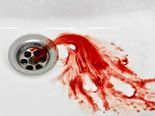 Are You Spitting Blood? Read This!!
