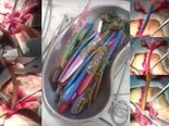 WTF!! He Ate 18 Toothbrushes & Metal Pieces??