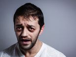 How Your Face Reflects Vitamin Deficiencies