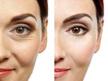 10 Natural Anti-wrinkle Treatments To Prepare At Home
