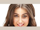 Effective Ways To Treat Dry Eyelids