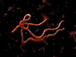 10 Warning Signs That Your Body Is Full Of Parasites 
