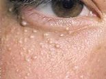 What Do Your Skin Patches Mean?