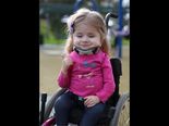 Her Bones Were Broken Even Before She Was Born!
