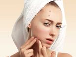 10 Face Packs To Treat The Toughest Acne You Are Bothered About