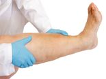 Things That Can Cause Too Much Fluid Retention In The Body