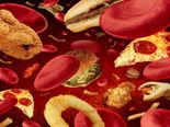 Worst Foods That Can Cause High Blood Pressure