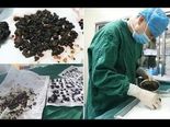 Most Bizarre Things Doctors Have Removed From Humans; #3 Is Shocking!