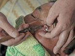 Heard Of “Eyeball Shaving”? Know Why It Is A Trend In China