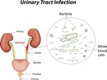 Study Shows Women With UTI Are Prone To Antibiotic Resistance; Home Remedies To Treat UTI