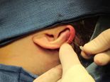When Doctors Removed 30 Maggots From A Woman's Ear!