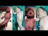 Can You Believe A Woman Gave Birth To A 'Mermaid Baby'?