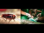 Case Of 26 Cockroaches That Were Breeding In A Man's Ear