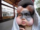 Weird Case Of A Woman Who Has Balloons Inserted In Her Face