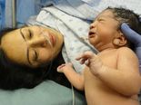 What Is External Cephalic Version? How Is It Done?