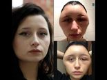 Shocking! Lady’s Head Expands After Using Hair Dye