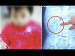 Mum Fed Her Newborn Child Calcium Supplements And This Happened!