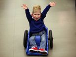 He Was Born Without A Brain, And He Survived