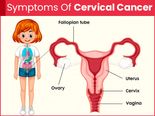 8 Alarming Symptoms Of Cervical Cancer In Women 