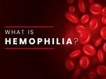 What Is Haemophilia? Its Causes, Symptoms, Complications, Diagnosis & Treatment