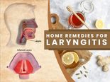10 Simple Home Remedies for Laryngitis (Hoarse Voice): Number Six Is The Simplest