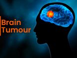 World Brain Tumour Day: Know The Types, Causes, Symptoms, Risk Factors, Diagnosis And Treatment