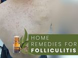 Folliculitis: Simple And Effective Home Remedies
