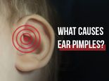 What Causes Ear Pimples And How To Treat Them