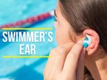 Swimmer’s Ear (Otitis Externa): Causes, Symptoms, Risk Factors, Diagnosis And Treatment 