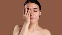 Scientists Discover Cell Protein That Keeps Kaposi's Sarcoma Herpesvirus Dormant: All About The Cancer Type