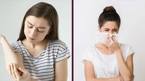 Monkeypox Vs Coronavirus: How The Two Infections Differ From Each Other