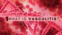 Ashton Kutcher's Autoimmune Disorder Left Him Blind And Disabled: Know About Vasculitis Causes And Treatment