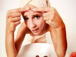 முகப்பருக்கள் ஏன் வருகிறது என்று தெரியுமா?