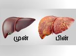இந்த 12 பழக்கவழக்கங்கள் உங்கள் கல்லீரலை சேதப்படுத்துகின்றன என தெரியுமா?