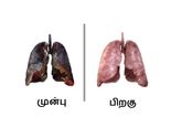 புகைத்து, புகைத்து பொசுங்கிப் போன நுரையீரலை சுத்தம் செய்யும் உணவுகள்! 
