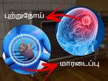 மைக்ரோவேவ் ஓவனில் சமைத்த உணவை சாப்பிடுவதால் உண்டாகும் 5 அபாயங்கள்!