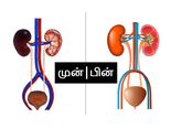 உடலில் தேங்கும் நச்சு மற்றும் கொழுப்பை வேகமாக அகற்ற பயன்தரும் ஜூஸ்!