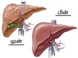 கல்லீரலை ஐந்தே நாட்களில் சுத்தம் செய்ய உதவும் அற்புத ஜூஸ்! 