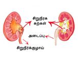 சிறுநீரக கற்களை கரைக்க உதவும், பசலைக்கீரை, வெள்ளரிக்காய் ஜூஸ்!