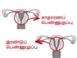 இரண்டு பெண்ணுறுப்புடன் வாழும் அதிசய பெண் தன் தாம்பத்தியம் பற்றி கூறும் இரகசியங்கள்!