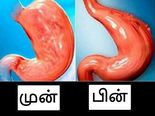அறுவை சிகிச்சை மேற்கொள்ளாமல், வயிற்றின் அளவை குறைப்பது எப்படி? 6 வழிகள்!