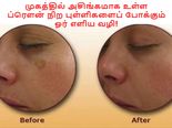 முகத்தில் அசிங்கமாக உள்ள ப்ரௌன் நிற புள்ளிகளைப் போக்க சரும நிபுணர் கூறும் ஓர் எளிய வழி!