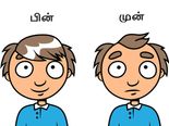 தலைமுடியின் அடர்த்தியை அதிகரிக்க வேண்டுமா? அப்ப இந்த இஞ்சி மாஸ்க் போடுங்க...